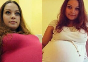 “ახალგაზრდა გოგონას მუცელი საოცრად ეზრდებოდა, ეგონა რომ ტყუპებს ელოდებოდა, მაგრამ..” – ნახეთ ეხოსკოპიაზე დაუჯერებელი რამ მოხდა