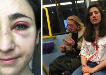 “მე ესპანელი ვარ, ის კი ინგლისელი… საღამოს ავტობუსში მას ვკოცნიდი… ოთხი ბიჭი ამოვიდა ავტობუსში და უმოწყალოდ გვცემეს…”