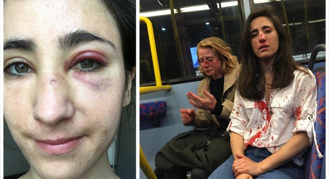 “მე ესპანელი ვარ, ის კი ინგლისელი… საღამოს ავტობუსში მას ვკოცნიდი… ოთხი ბიჭი ამოვიდა ავტობუსში და უმოწყალოდ გვცემეს…”