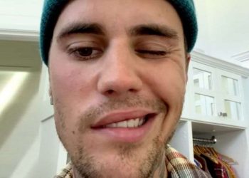 ჯასტინ ბიბერმა გაამხილა, რომ სახის ნაწილი პარალიზებული აქვს￼