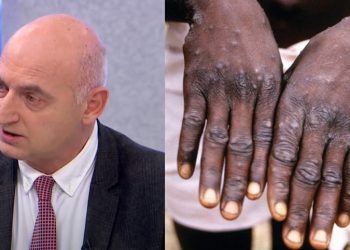 ვინც 1980 წლამდე დაიბადეთ… – რა ინფორმაცია გახდა ცნობილი “მაიმუნის ყვავილთან” დაკავშირებით