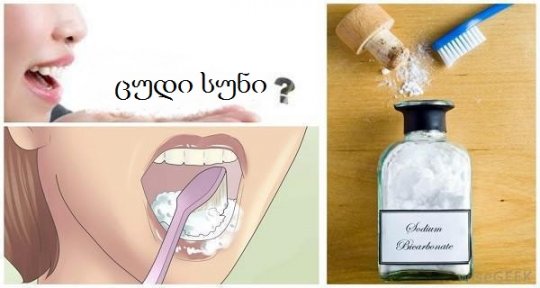 როგორ მოვიშოროთ უსიამოვნო სუნი პირის ღრუდან – გამოსავალი არსებობს და ძალიან მარტივია !