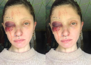 „ბევრი ვიფიქრე ეს გამეკეთებინა თუ არა და ხმამაღლა მესაუბრა თუ არა..” – ქართველი მოდელი ფიზიკური ძალადობის შესახებ წერს