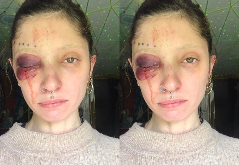 „ბევრი ვიფიქრე ეს გამეკეთებინა თუ არა და ხმამაღლა მესაუბრა თუ არა..” – ქართველი მოდელი ფიზიკური ძალადობის შესახებ წერს