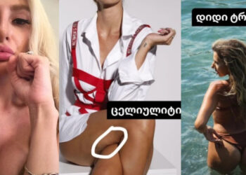 “დიდი ტრა**, ცხვირი, ცელულიტი.. არავის მისცეთ უფლება დაგაკომპლექსოს” – რა ფოტოებს აქვეყნებს ნუკი კოშკელიშვილი