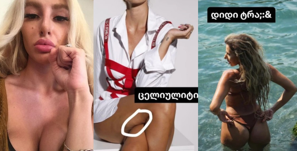 “დიდი ტრა**, ცხვირი, ცელულიტი.. არავის მისცეთ უფლება დაგაკომპლექსოს” – რა ფოტოებს აქვეყნებს ნუკი კოშკელიშვილი