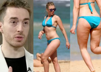 ,,ქალების 85-90%-ს ეს პრობლემა აწუხებს” – როგორ მოვიშოროთ სახლის პირობებში ცელულიტი მარტივი და ეფექტური გზით