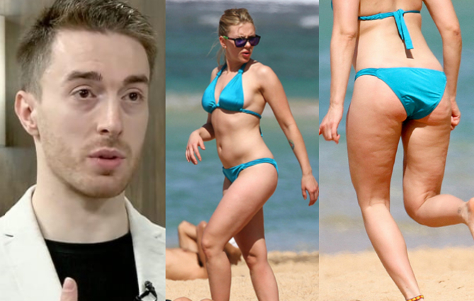 ,,ქალების 85-90%-ს ეს პრობლემა აწუხებს” – როგორ მოვიშოროთ სახლის პირობებში ცელულიტი მარტივი და ეფექტური გზით