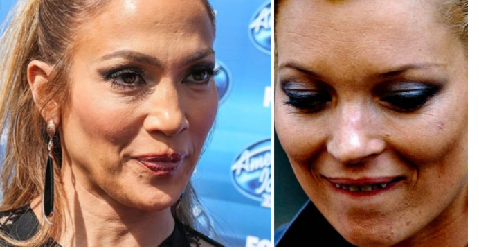 პაპარაცებმა ჰოლივუდის ვარსკვლავები ახლოდან აჩვენეს და გააქარწყლეს მითები მათი უნაკლო სილამაზის შესახებ (ფოტოები)