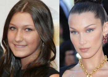 პლასტიკური ქირურგია 14 წლის ასაკში, ანორექსია, მძიმე დიაგნოზი და გავლენიანი მშობელი – ბელა ჰადიდის გზა მორცხვი გოგონადან ყველაზე ლამაზი ქალის ტიტულამდე