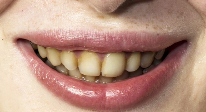 10 ნიშანი იმისა, რომ ქალი თავს არ უვლის და მას ვერცერთი ძვირადღირებული ტანსაცმელი ვერ დაამშვენებს