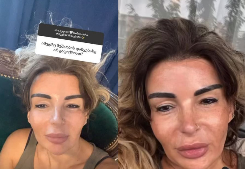 “მირჩიეს, ფილტრი არ დაიდო სახეზე, საშინლად გაქვსო”- მაია ასათიანი