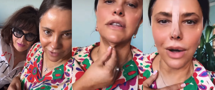 მინდა შემოგთავაზოთ სახის აჭიმვა ოპერაციის გარეშე – რა ვიდეოს აქვეყნებს ია ფარულავა