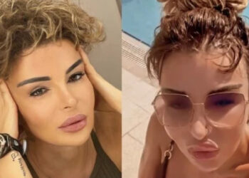 “და აი დადგა ის დღეც”- მაია ასათიანმა ნაოპერაციები მუცელი გამოაჩინა