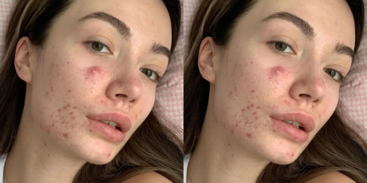 რა ემართება ქალის ორგანიზმს თუ მას დიდხანს არ აქვს სექსი