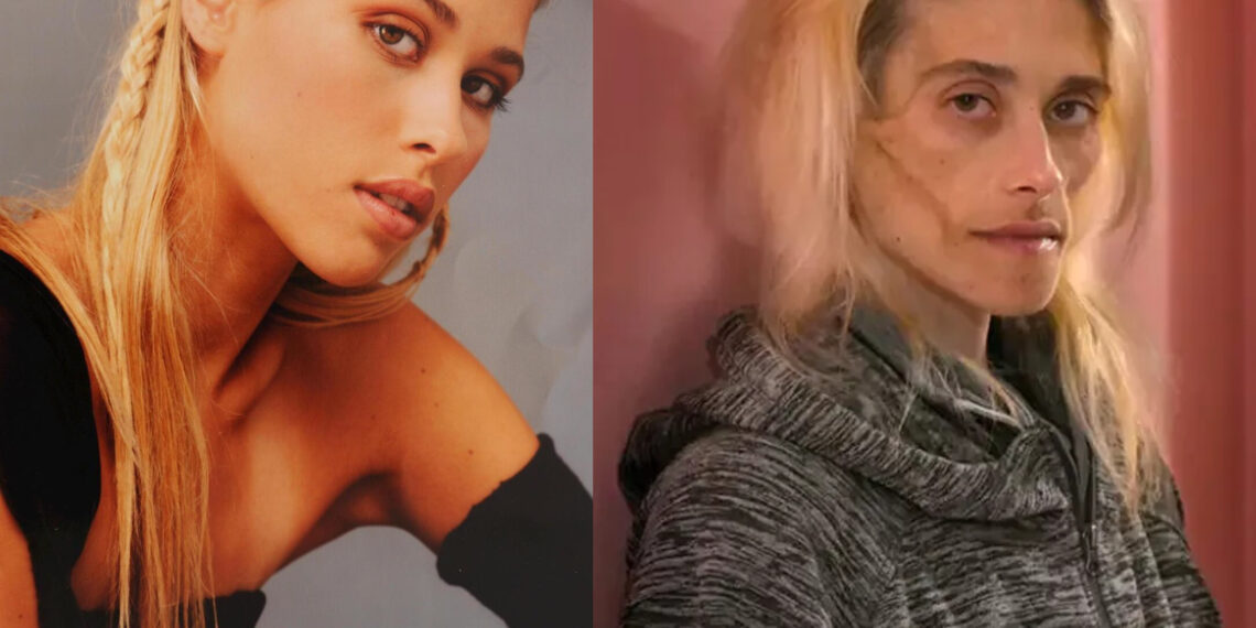 უეცრად დამჭკნარი სილამაზე და 35 წლის ასაკში გარდაცვალება – ცნობილი მოდელის ტრაგიკული ცხოვრება და სიცოცხლის ბოლო წუთებში გადაღებული ფოტო