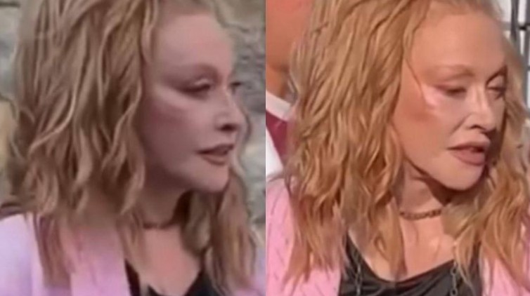 “რა ჭირს ალას?” – სახის დაჭიმვისა და თმის გადანერგვის შემდეგ მომღერალი სხვაგვარად გამოიყურება – ნახეთ 74 წლის ალა პუგაჩოვას ახალი ფოტოები