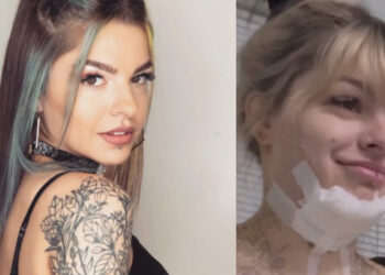 ვიდეო : თი მაჭავარიანის რეაქცია, როცა ოპერაციის შემდეგ სახვევები მოიხსნა და საკუთარი სხეული პირველად ნახა