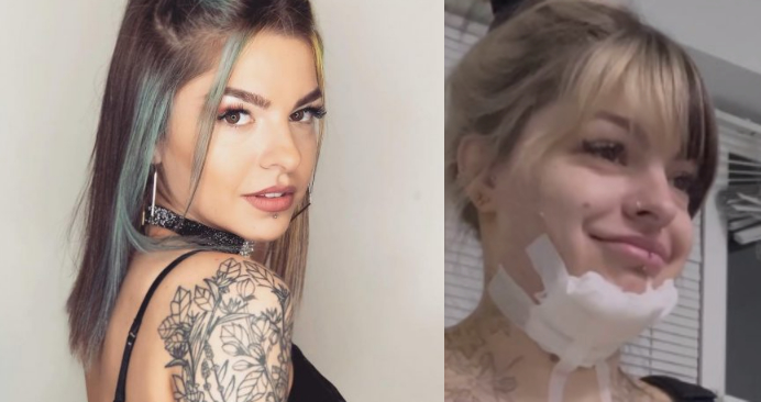 ვიდეო : თი მაჭავარიანის რეაქცია, როცა ოპერაციის შემდეგ სახვევები მოიხსნა და საკუთარი სხეული პირველად ნახა