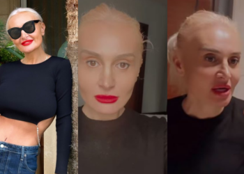 რა პროცედურა ჩაიტარა ნანუკა ჟორჟოლიანმა სახეზე ? – “შედეგი იქნება 10 დღეში”