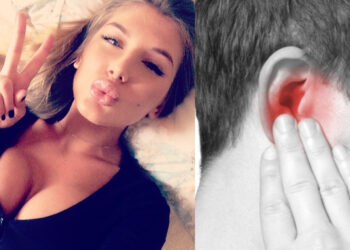 რუსმა ქალმა ზემდეტი ვნებისგან კაცს ყური მოაჭამა – ადგილზე მისულ სასწრაფოს შემზარავი სურათი დახვდა