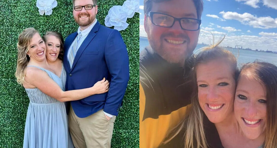 მსოფლიოში ყველაზე ცნობილი სიამის ტყუპი დებიდან ერთი დაქორწინდა – ფოტო ქორწილიდან