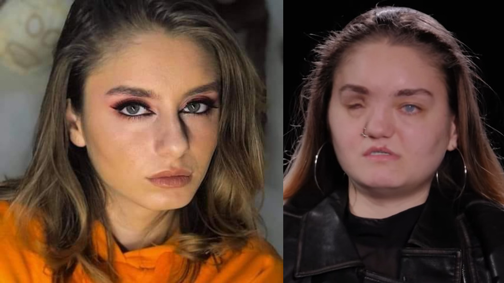 როგორ გამოიყურებოდა მარიამ ტატანაშვილი საზარელ ავარიამდე – უმძიმესი შემთხვევა, რომლის შესახებაც გოგონა გადაცემაში “ნოესთან” ყვება