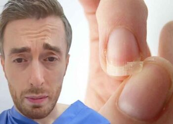 3 მარტივი გზა თუ ფრჩხილები ადვილად გტყდება და თმა მარტივად გცვივა