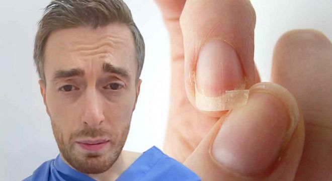 3 მარტივი გზა თუ ფრჩხილები ადვილად გტყდება და თმა მარტივად გცვივა