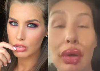 რა შეემთხვა ქეთა თოფურიას სახეზე ? – მომღერალის ვიდეოს დიდი გამოხმაურება მოჰყვა