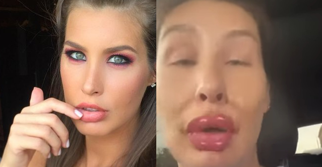 რა შეემთხვა ქეთა თოფურიას სახეზე ? – მომღერალის ვიდეოს დიდი გამოხმაურება მოჰყვა