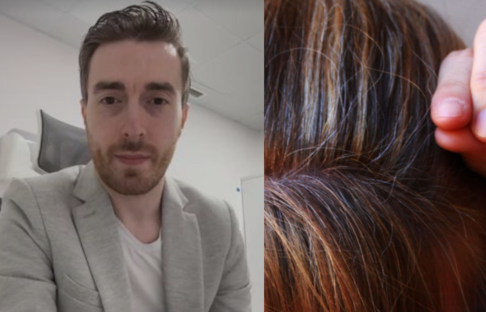 “ერთი ჭაღარა თმა რომ ამოვიძრო, უფრო მეტი ჭაღარა ამომივა?” – რისი ბრალია ნაადრევი ან სწრაფი გაჭაღარავება და როგორ შეგიძლიათ ამ პროცესის შენელება