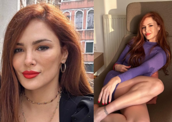 რთული დასაჯერებელია – როგორ გამოიყურებოდა ცნობილი თურქი მსახიობი მინე თუგაი პლასტიკურ ოპერაციებამდე