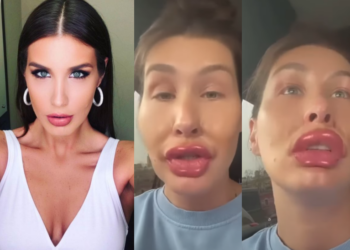 ”ცოტა ფილერი გავიკეთე სახეზე და ტუჩზე” – რა ვიდეოს აქვეყნებს ქეთა თოფურია ?