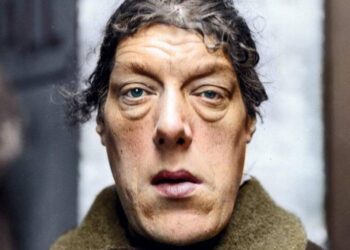 “ეს არის მერი ენ ბევანი, რომელიც ცნობილი იყო, როგორც “ყველაზე მახინჯი ქალი მსოფლიოში”, მაგრამ როდესაც გაიგებთ მის ცხოვრებას, თქვენ მას “მსოფლიოში ყველაზე ლამაზ ადამიანს” უწოდებთ…”