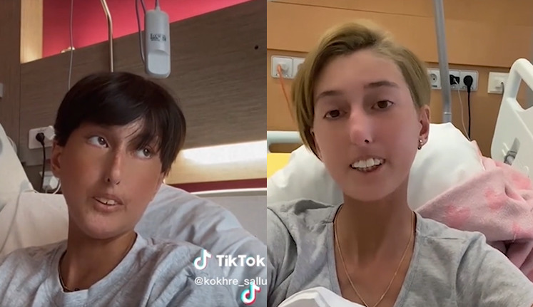 “ექიმი გაოგნებული იყო, რა ხდება ჩვენს თავს არ ვიციო” – ახალგაზრდა გოგოს, რომელსაც მთელი საქართველო გულშემატკივრობს, სიახლე აქვს