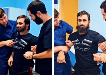 კარგი ამბავი – ცნობილი ტყუპი ძმები 2-თვიანი რეაბილიტაციის შემდეგ ფეხზე დადგნენ