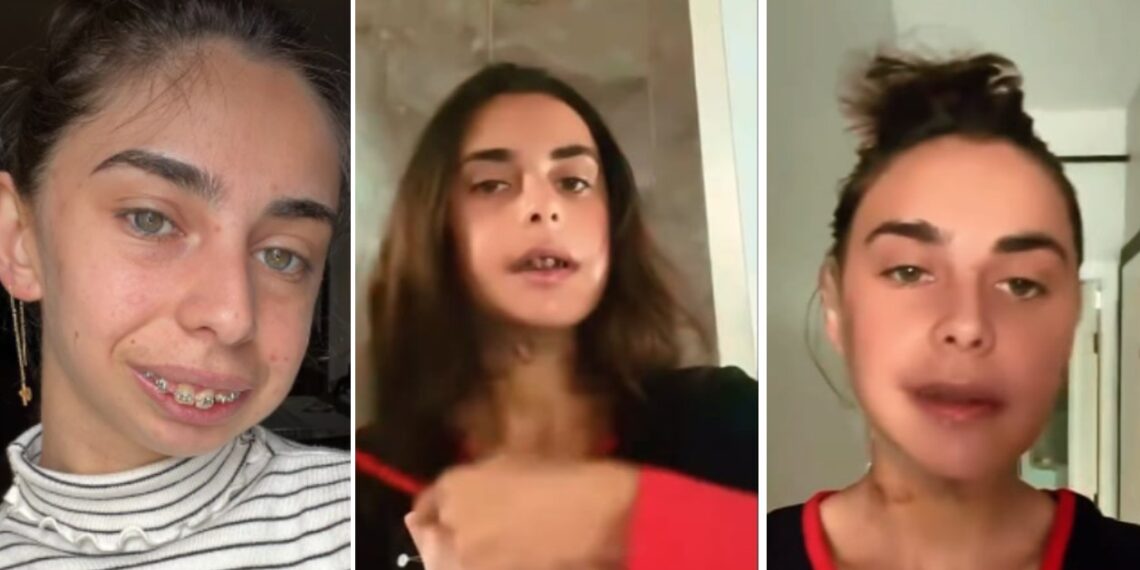 ლილიანას მდგომარეობა ყოველდღიურად უმჯობესდება – რა ემოციურ მიმართვას ავრცელებს გოგონა კლინიკიდან გაწერის შემდეგ ?