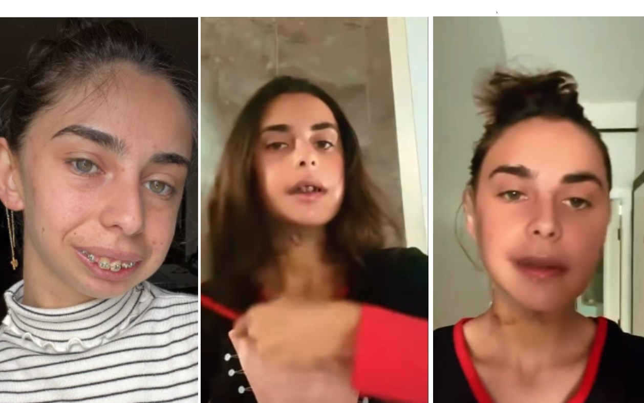 ლილიანას მდგომარეობა ყოველდღიურად უმჯობესდება – რა ემოციურ მიმართვას ავრცელებს გოგონა კლინიკიდან გაწერის შემდეგ ?