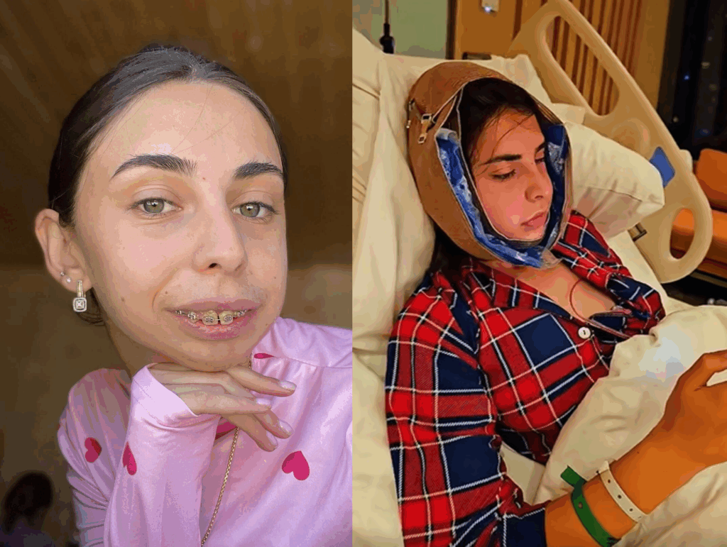 ლილიანას რეაქცია, როდესაც მისი ახალი სახე პირველად ნახა – ვიდეო