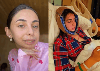 ლილიანას რეაქცია, როდესაც მისი ახალი სახე პირველად ნახა – ვიდეო