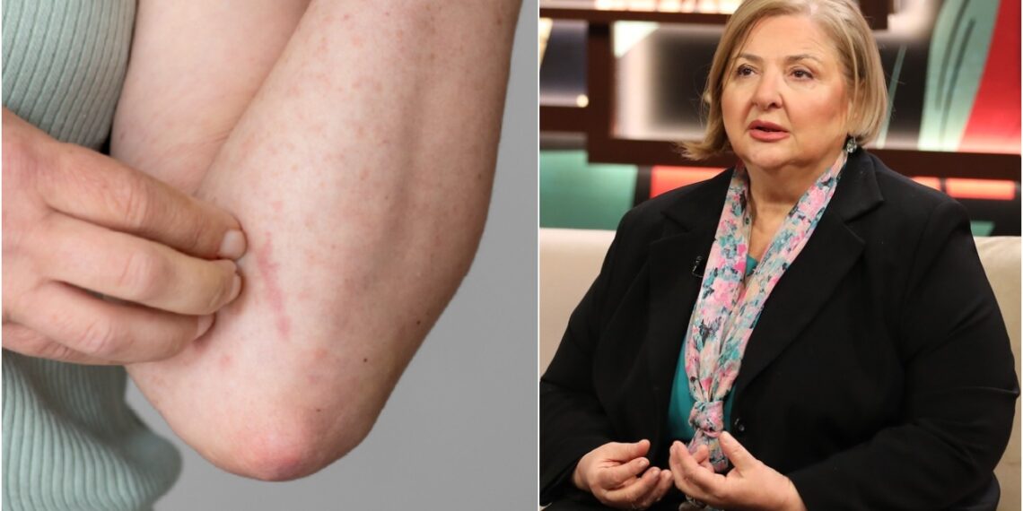 უნდა გადავყაროთ თუ არა მუნით დაინფიცირებული სამოსი ? – რას ამბობს დერმატო-ვენეროლოგი თინა ქიტუაშვილი