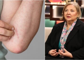 უნდა გადავყაროთ თუ არა მუნით დაინფიცირებული სამოსი ? – რას ამბობს დერმატო-ვენეროლოგი თინა ქიტუაშვილი