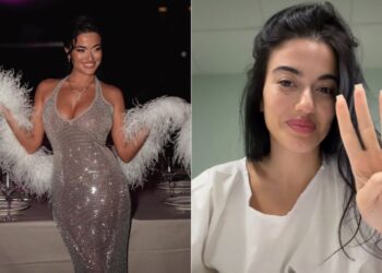 „ბევრი წელი ფიქრის შემდეგ, მე ეს გავაკეთე“ – ანანო სახელაშვილმა ცხვირის ოპერაცია გაიკეთა