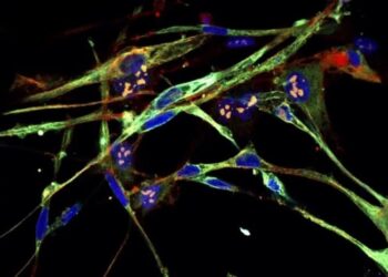 სიმპტომები, რომლებიც შეიძლება ახასიათებდეს პანკრეასის კიბოს