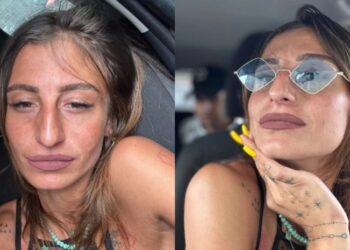 ქეთი ქველაძეს ვეღარ იცნობთ – ცნობილმა ტიკ-ტოკერმა ტუჩები გაიდიდა