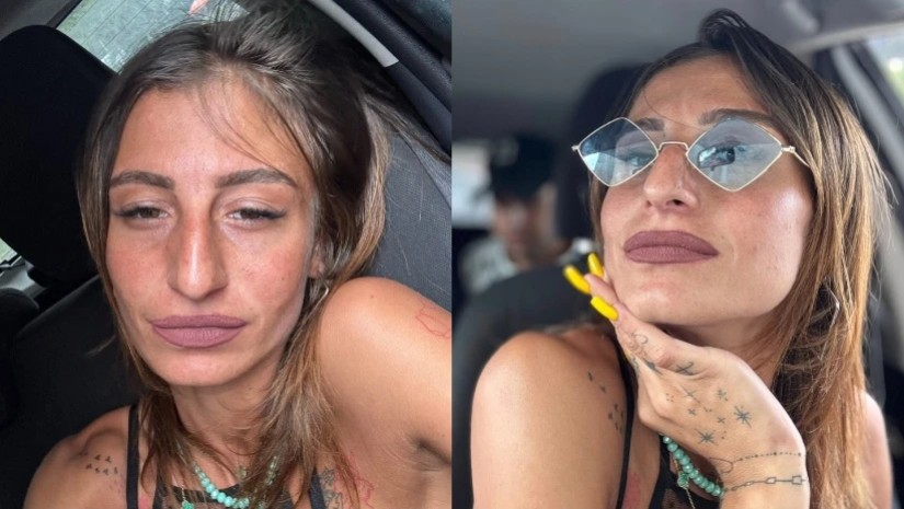 ქეთი ქველაძეს ვეღარ იცნობთ – ცნობილმა ტიკ-ტოკერმა ტუჩები გაიდიდა